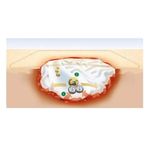 curativo-venosan-suprasorb-a-de-alginato-de-calcio-esteril-10-10-cm-2