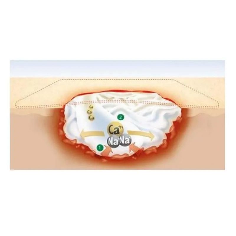 curativo-venosan-suprasorb-a-de-alginato-de-calcio-esteril-10-10-cm-2