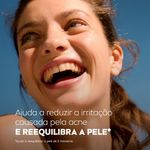 4005900945693-NIVEAHidratanteFacialAcneControl50g-2.jpg