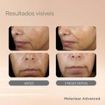 serum-facial-isdin-isdinceutics-melaclear-advanced-30ml-2.jpg