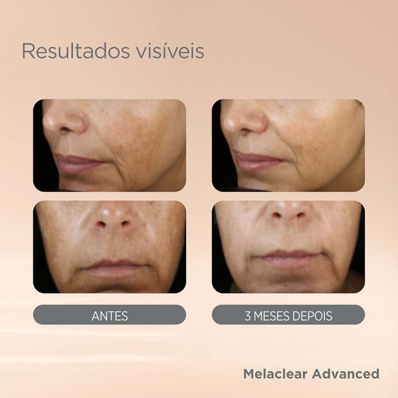 serum-facial-isdin-isdinceutics-melaclear-advanced-30ml-2.jpg