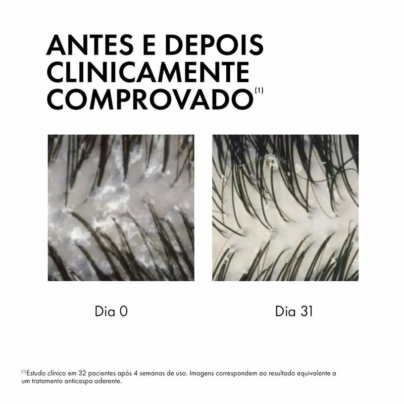 serum-10-vichy-dercos-anticaspa-100ml-4